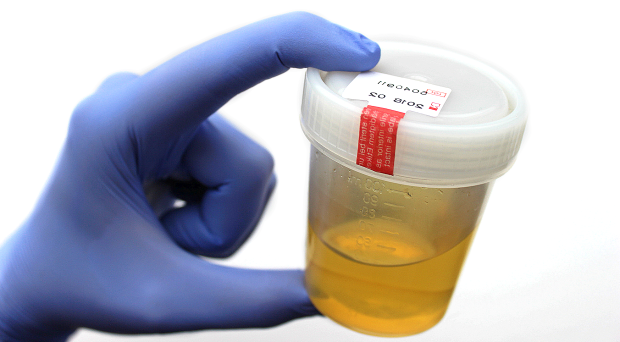 Synthetic Urine